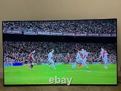 Sony Bravia Kd55a1 55 Inch Oled 4k Ultra Hdr Smart Android Tv Screen Burn