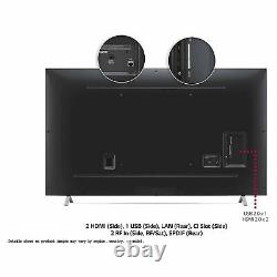 Lg 70up76706lb 70 Pouces 4k Smart Ultra Hd Tv
