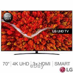 Lg 70up81006la 70 Pouces 4k Ultra Hd Smart Tv