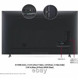 Lg 82up80006la 82 Inch Tv Smart 4k Ultra Hd Led Analogique Et Bluetooth Numérique Wifi